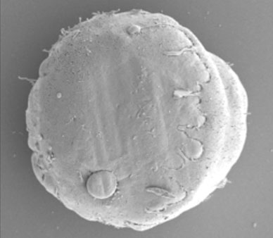Electron microscopy image of wild-type control stem cell